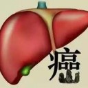 肝癌