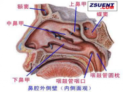 鼻内镜手术