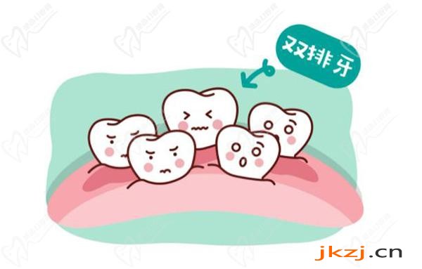 乳牙滞留是什么原因造成的