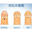 包皮包茎