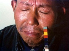 中医望色之客色赤