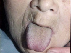 中医望色之面青灰