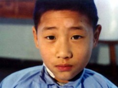 中医望色之面色萎黄而黑