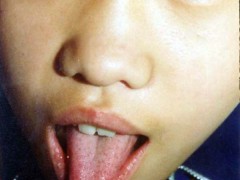 中医望色之面色青黄