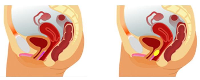 性腺激活