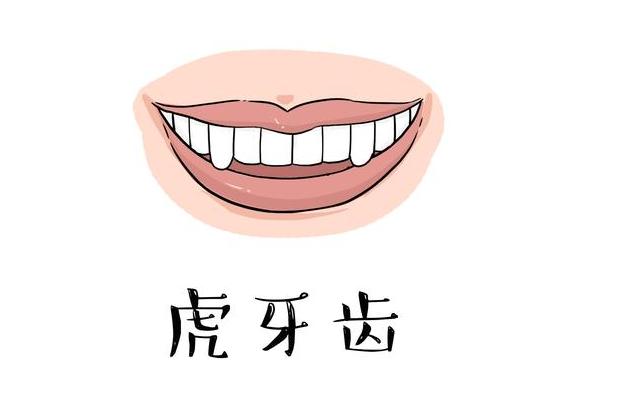 虎牙矫正