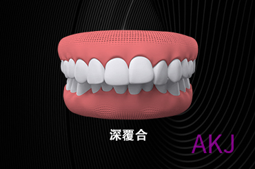 深覆合