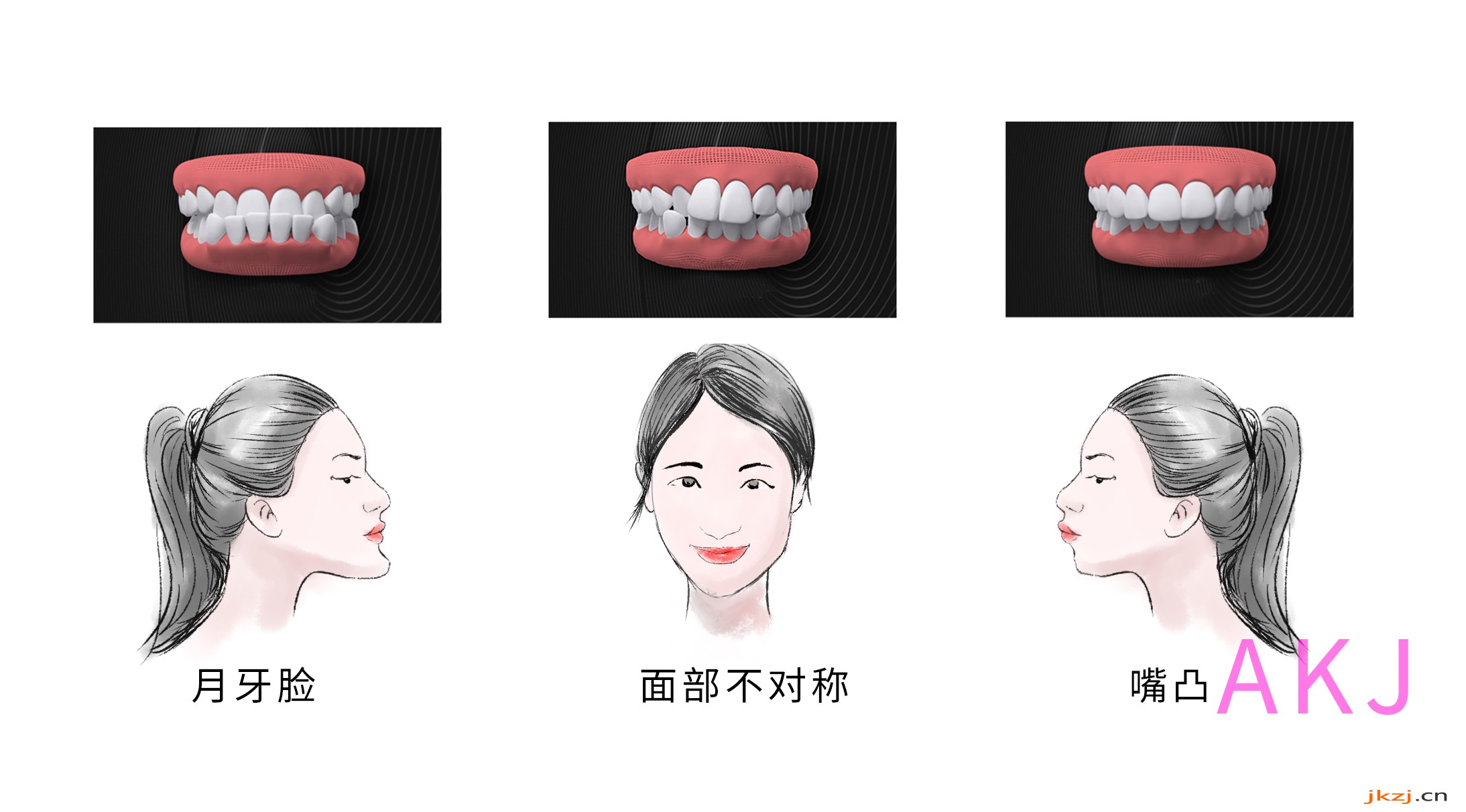 牙齿畸形