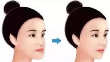 儿童牙齿矫正费用