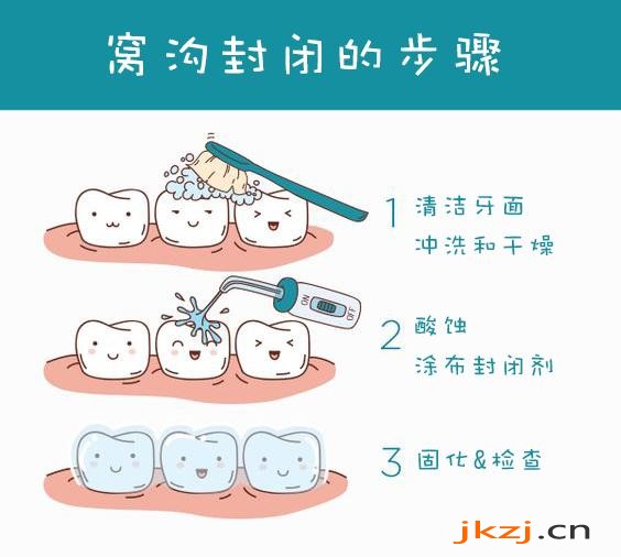 做窝沟封闭多少钱