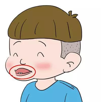 反颌矫正手术多少钱