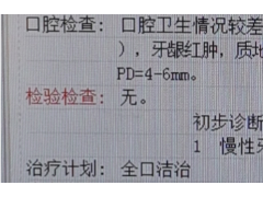 塞牙、异味、爱出血？当心患上牙周炎！