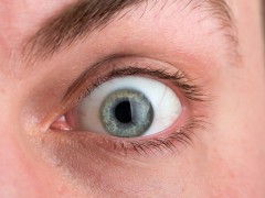 1型糖尿病的病因是免疫和遗传吗