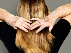 女性患上了子宫内膜异位会有哪些表现症状
