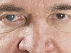 怎样正确预防干眼症