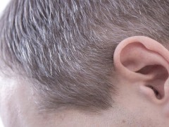 男人掉头发的原因是什么？