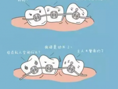 牙齿矫正年龄段是多少岁？深圳牙齿正畸费用一般多少