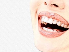 杭州雅莱口腔门诊部牙齿稀疏多少钱？好评医院介绍