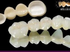 苏州牙科门诊补牙费用大揭秘！一颗补牙大约多少钱？