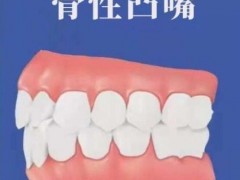 苏州牙科医院Top5名单曝光！惊喜携手，牙齿美容专家领先一步！