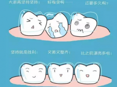 牙齿矫正医院如何选择？重庆牙齿正畸多少钱