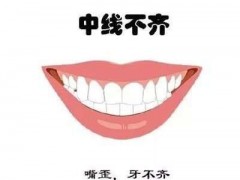 武汉矫正一颗牙需要多少钱?公立or私立如何选择？
