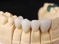 长沙烤瓷牙多少钱一颗？各医院做烤瓷牙优势分析