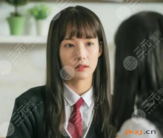 朴敏英整容史