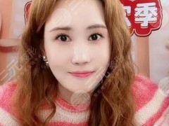 曾经红遍全亚洲的韩国女神，如今脸变得认不出了？