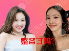 TWICE娜琏整容了？韩国人气女爱豆被指做了鼻子？她到底整了吗？