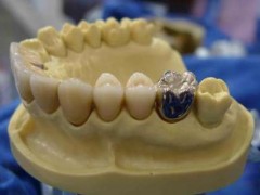 杭州比较好的私立口腔医院排行榜：揭秘时光医疗美容医院排名第三之外的其他医疗机构