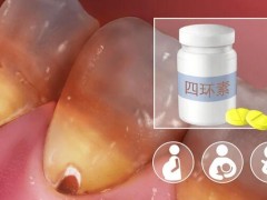 2025年广州可靠口腔医院排名榜单揭晓，价格实惠的医院在哪里？柏德口腔和广大口腔上榜！