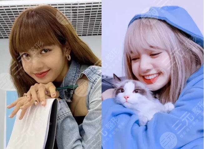 lisa整容
