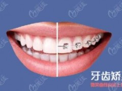 重庆烤瓷牙技术排名TOP3正规医院！了解这两家口腔机构