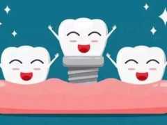 北京种牙多少钱一颗啊