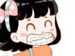 上海儿童牙齿矫正价格怎么样？详解材料费是多少！