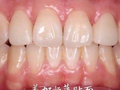 深圳富华口腔的医生名单和种牙案例让人印象深刻！赞誉不断！