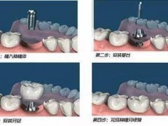 南京医疗口腔诊所排名推荐，性价比高的医院有哪些？