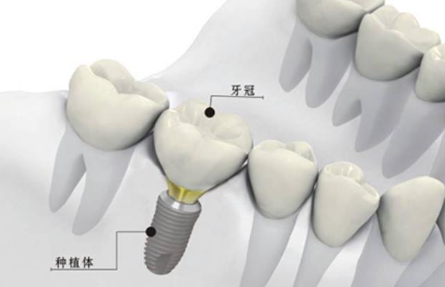 成都哪家口腔医院的牙科口碑比较好？体验评级全新揭晓！【2024专业评估】