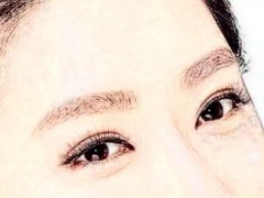 深圳美莱开眼角价格2025|费用一目了然