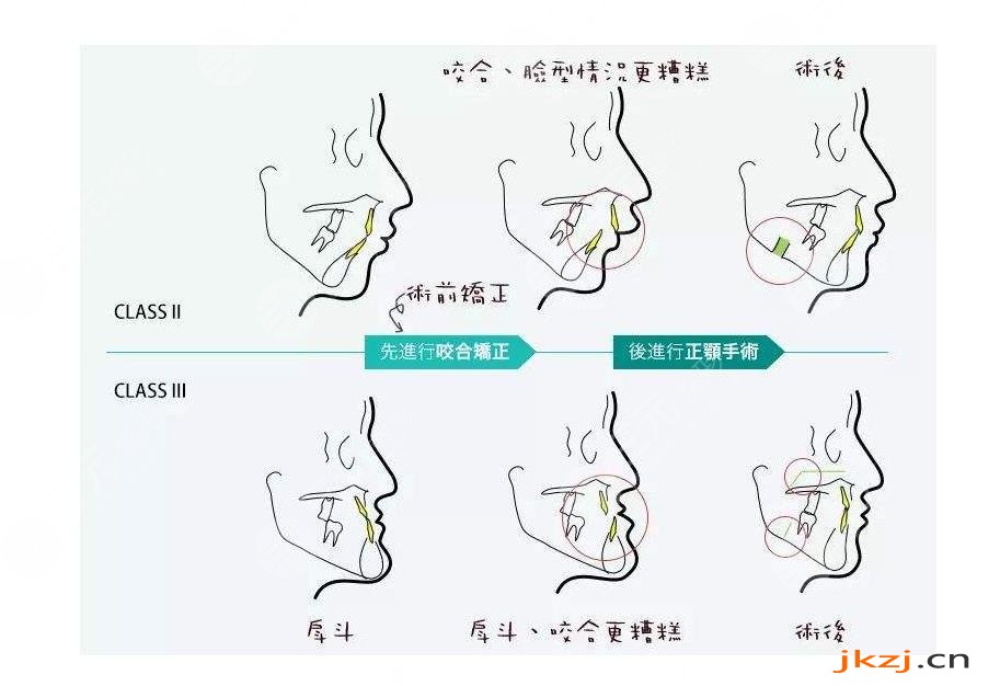 颌面知识科普