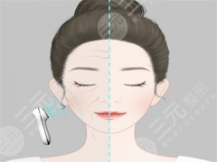 宁波割双眼皮哪家整形医院好