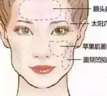 威海孙漫整形医院价格表一览