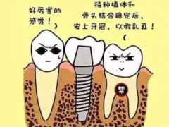 天津种一颗牙大概要多少钱？价格影响因素/注意事项整理