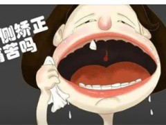 郑州有哪些性价比高的种植牙医院？
