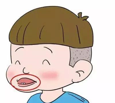 东莞矫正一颗牙需要多少钱？牙齿矫正方式科普