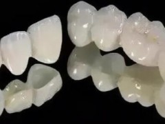 东莞地区有哪些正规口腔医院？口腔医院排行榜及收费价格一览！
