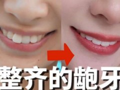 宁波第二医院口腔科的口碑如何？推荐你认识下这两名备受好评的医生！种植牙费用一览等你