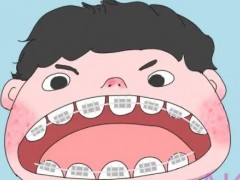 青岛瓷牙价格更新了吗？影响价格的因素有哪些？注意事项有哪些？