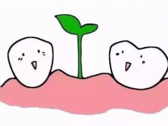 佛山矫正一颗牙需要多少钱？矫正牙齿要拔牙吗？